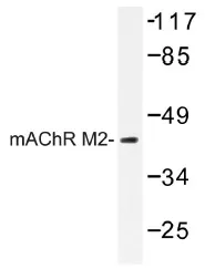 CHRM2 Rabbit Polyclonal Antibody - image 1