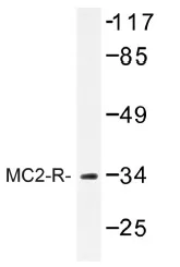 MC2 receptor (MC2R) Rabbit Polyclonal Antibody - image 1