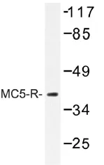 MC5R Rabbit Polyclonal Antibody - image 1