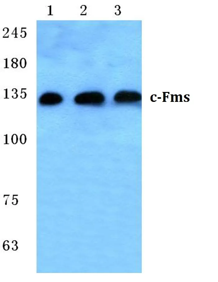 MCSF Receptor (CSF1R) Rabbit Polyclonal Antibody - image 1