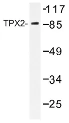 TPX2 Rabbit Polyclonal Antibody - image 1