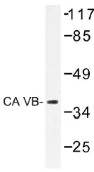CA5B Rabbit Polyclonal Antibody - image 1