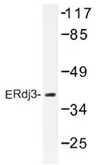 DNAJB11 Rabbit Polyclonal Antibody - image 1