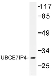 RNF144 (RNF144A) Rabbit Polyclonal Antibody - image 1