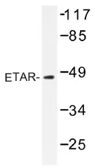 Endothelin A Receptor (EDNRA) Rabbit Polyclonal Antibody - image 1