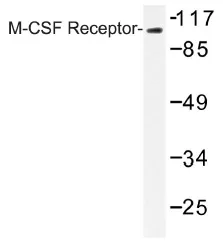 MCSF Receptor (CSF1R) Rabbit Polyclonal Antibody - image 1