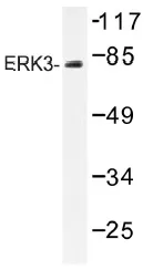 MAPK6 Rabbit Polyclonal Antibody - image 1