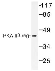 PRKAR2B Rabbit Polyclonal Antibody - image 1
