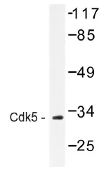 CDK5 Rabbit Polyclonal Antibody - image 1