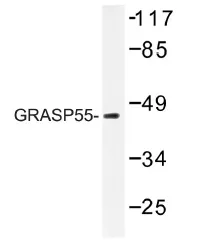 GORASP2 Rabbit Polyclonal Antibody - image 1