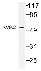 KCNS2 Rabbit Polyclonal Antibody - image 1