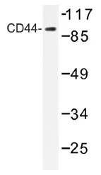 CD44 Rabbit Polyclonal Antibody - image 1
