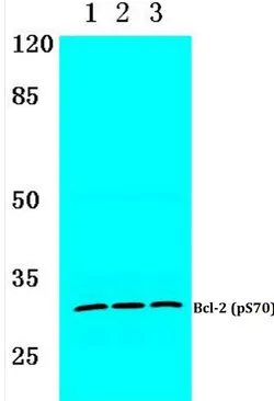 BCL2 pSer70 Rabbit Polyclonal Antibody - image 1