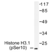 H3FA (HIST1H3A) pSer10 Rabbit Polyclonal Antibody - image 1