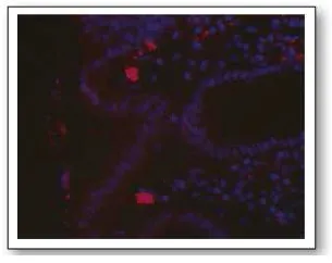 Helicobacter pylori Goat Polyclonal Antibody - image 1