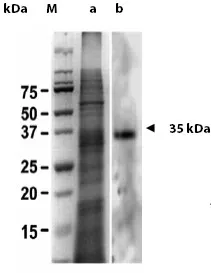 Galectin 2 (LGALS2) Rabbit Polyclonal Antibody - image 1