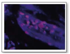 Tuberoinfundibular peptide (PTH2) Rabbit Polyclonal Antibody - image 1