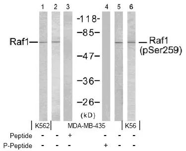 RAF1 Rabbit Polyclonal Antibody - image 1