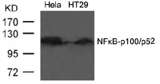NFkB p100 / p52 (NFKB2) Rabbit Polyclonal Antibody - image 1