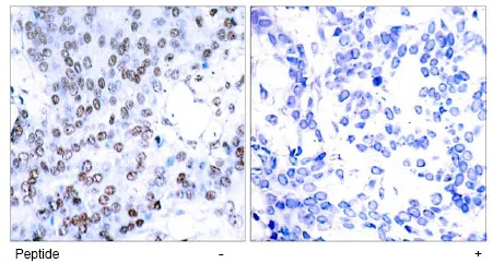 JUNB Rabbit Polyclonal Antibody - image 1