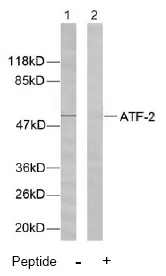 ATF2 Rabbit Polyclonal Antibody - image 1