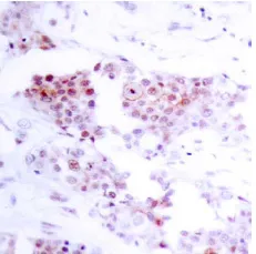 MEF2A Rabbit Polyclonal Antibody - image 1