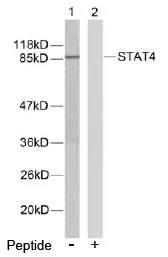 STAT4 Rabbit Polyclonal Antibody - image 1
