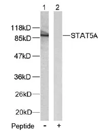 STAT5A Rabbit Polyclonal Antibody - image 1
