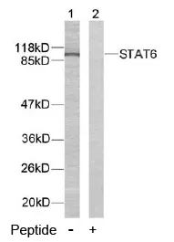 STAT6 Rabbit Polyclonal Antibody - image 1