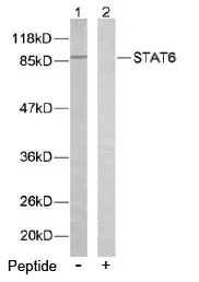 STAT6 Rabbit Polyclonal Antibody - image 1