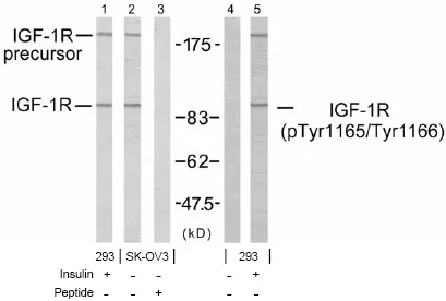 IGF1 Receptor (IGF1R) Rabbit Polyclonal Antibody - image 1