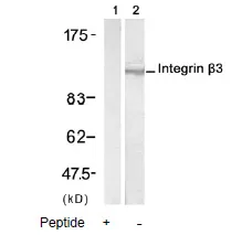 CD61 (ITGB3) Rabbit Polyclonal Antibody - image 1