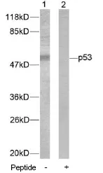 p53 (TP53) Rabbit Polyclonal Antibody - image 1