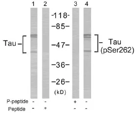 MAPT / TAU Rabbit Polyclonal Antibody - image 1