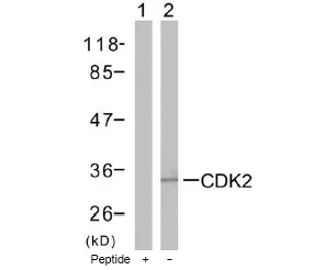 CDK2 Rabbit Polyclonal Antibody - image 1