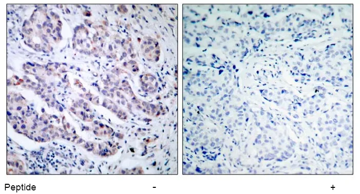 TYK2 Rabbit Polyclonal Antibody - image 1