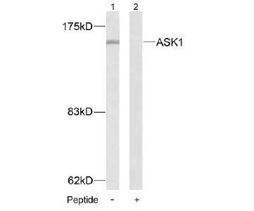 ASK1 (MAP3K5) Rabbit Polyclonal Antibody - image 1