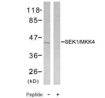 MEK4 (MAP2K4) Rabbit Polyclonal Antibody - image 1