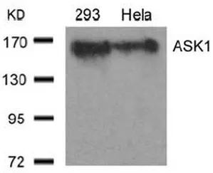 ASK1 (MAP3K5) Rabbit Polyclonal Antibody - image 1