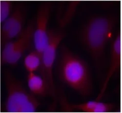 HDAC2 Rabbit Polyclonal Antibody - image 1