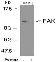 FAK (PTK2) Rabbit Polyclonal Antibody - image 1