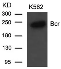 BCR Rabbit Polyclonal Antibody - image 1