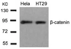 beta Catenin (CTNNB1) Rabbit Polyclonal Antibody - image 1