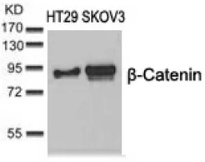 beta Catenin (CTNNB1) Rabbit Polyclonal Antibody - image 1