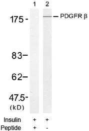 PDGF Receptor beta (PDGFRB) Rabbit Polyclonal Antibody - image 1