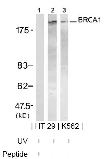 BRCA1 Rabbit Polyclonal Antibody - image 1
