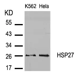 HSP27 (HSPB1) Rabbit Polyclonal Antibody - image 1