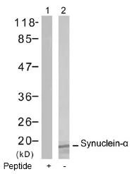 alpha Synuclein (SNCA) Rabbit Polyclonal Antibody - image 1