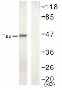 MAPT / TAU Rabbit Polyclonal Antibody - image 1