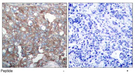 Cortactin Rabbit Polyclonal Antibody - image 1